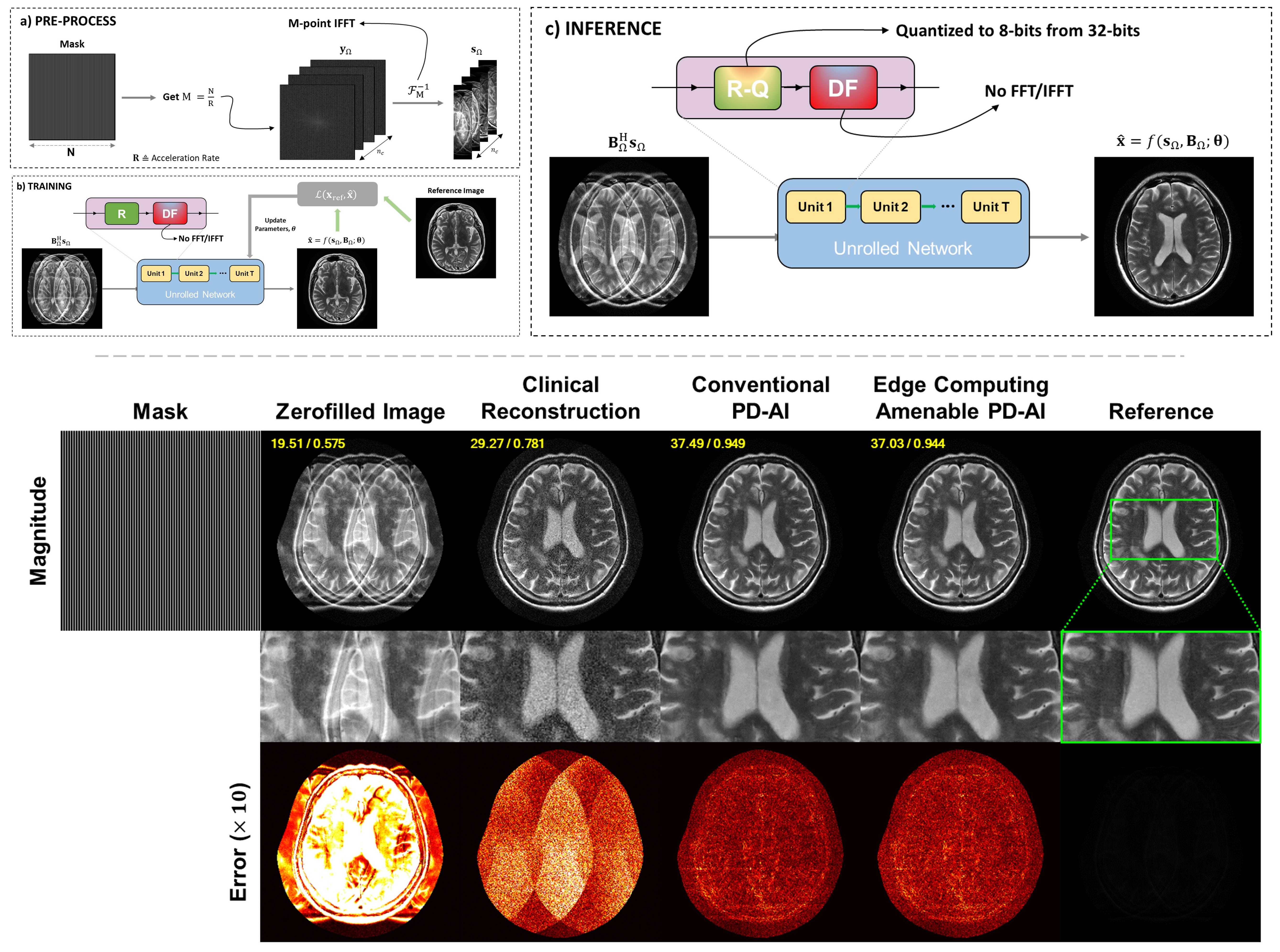 Edge Computing for Physics-Driven AI in Computational MRI: A Feasibility Study