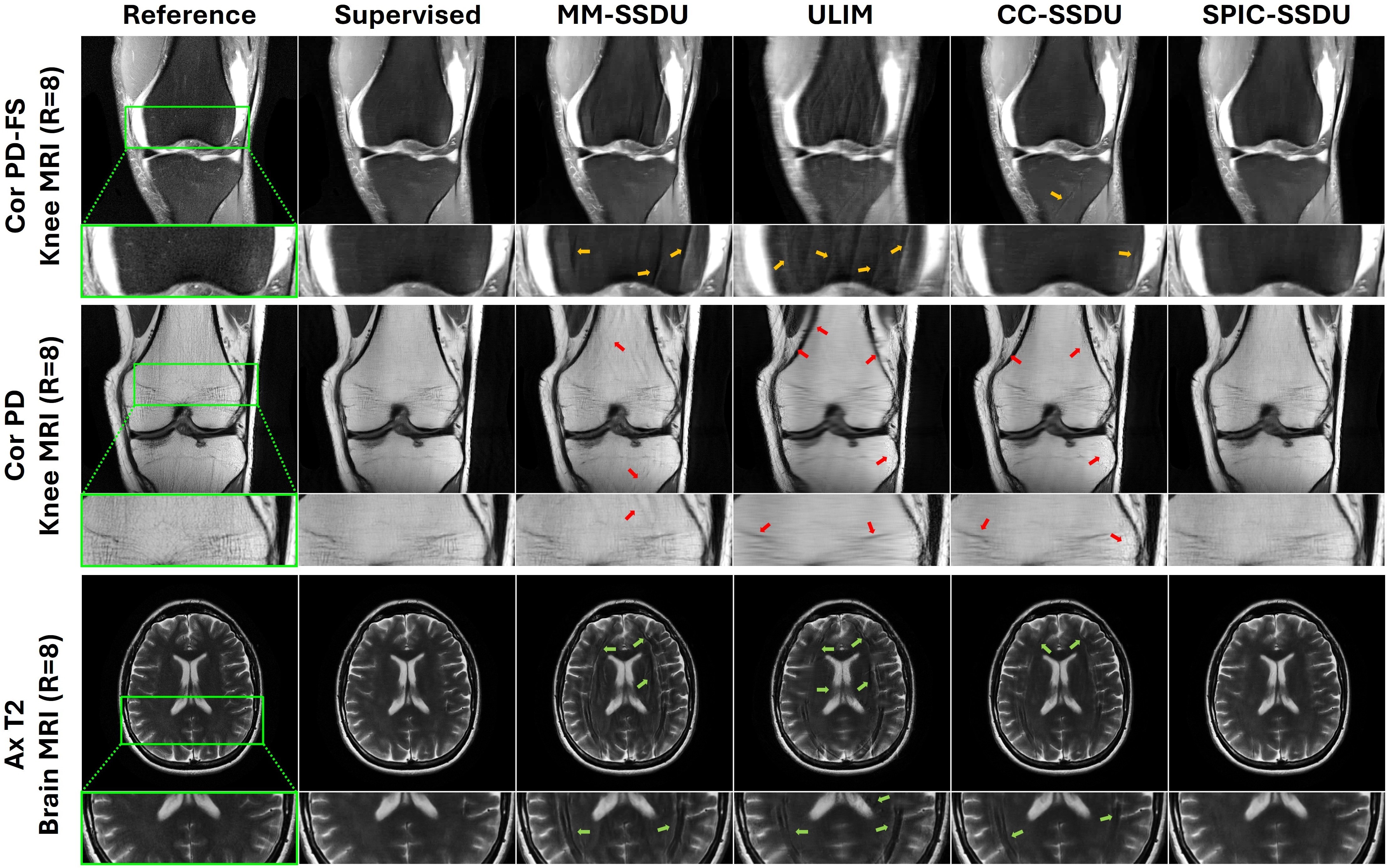 Sparsity-Driven Parallel Imaging Consistency for Improved Self-Supervised MRI Reconstruction