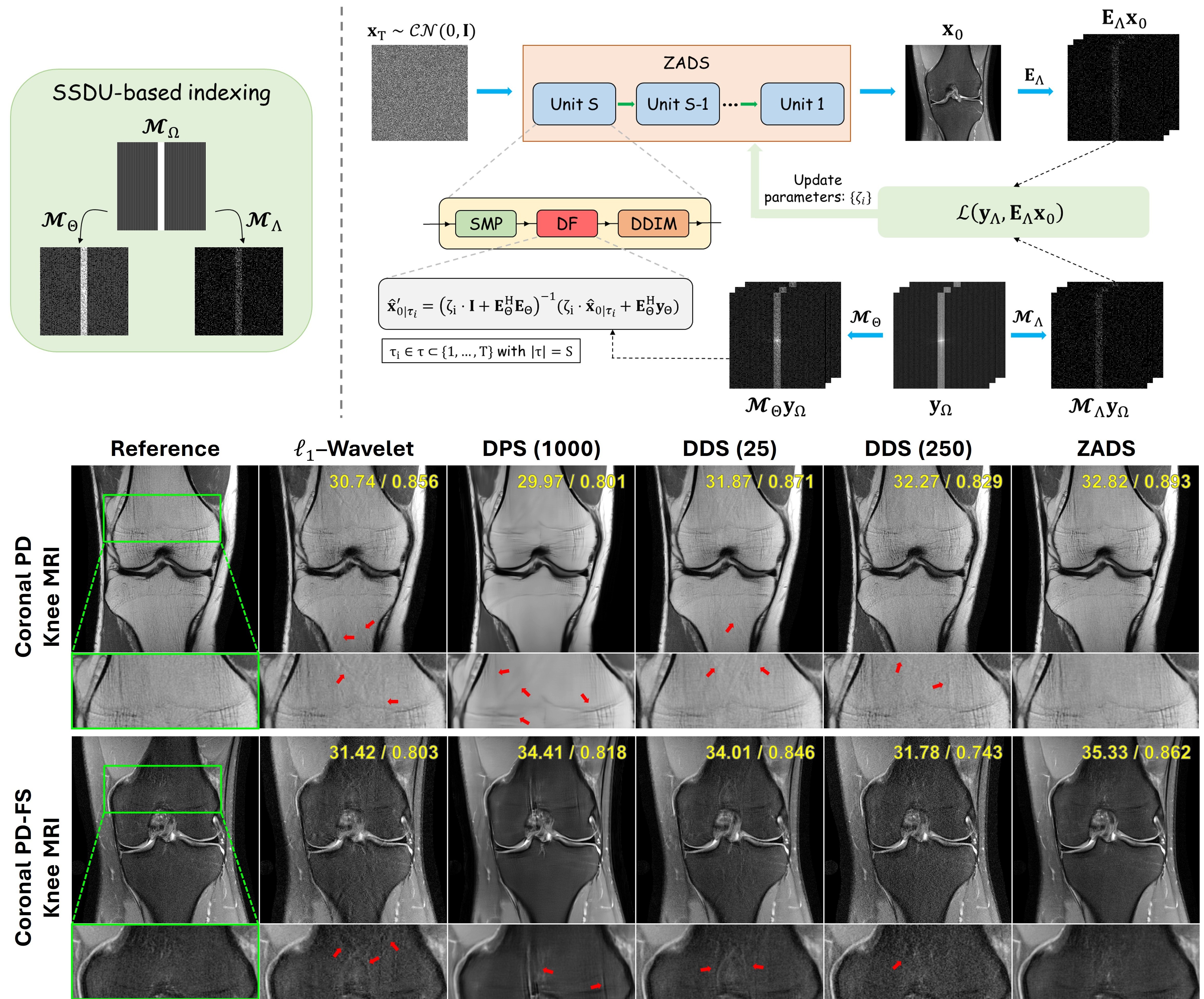 Automated Tuning for Diffusion Inverse Problem Solvers without Generative Prior Retraining